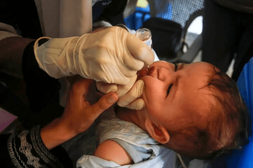 Polio